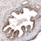 Immunohistochemical staining of human prostate shows moderate to strong nuclear positivity in glandular cells.