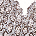 Immunohistochemical staining of human colon shows strong nuclear positivity in glandular cells.