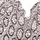 Immunohistochemical staining of human colon shows strong nuclear positivity in glandular cells.
