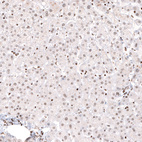 Immunohistochemical staining of human liver shows weak nuclear positivity in hepatocytes.