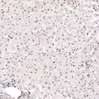 Immunohistochemical staining of human liver shows weak nuclear positivity in hepatocytes.