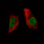 Immunofluorescence staining of A-431 cells using the Anti-ARID1A monoclonal antibody, showing specific staining in the nucleoplasm in green. Microtubule- and nuclear probes are visualized in red and blue, respectively (where available).