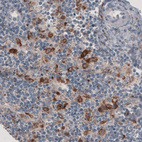 Immunohistochemical staining of human lymph node shows strong positivity in a subset of lymphoid cells.