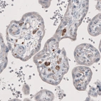 Immunohistochemical staining of human placenta shows immunoreactivity in a subset of lymphoid cells.