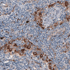 Anti-FCGRT Antibody