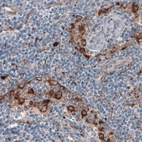Anti-FCGRT Antibody