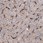 Anti-FCGRT Antibody