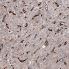 Immunohistochemical staining of human liver shows strong immunoreactivity in Kupffer cells.