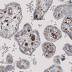 Immunohistochemical staining of human placenta shows positivity in a subset of lymphoid cells.