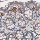 Anti-FCGRT Antibody