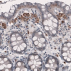 Immunohistochemical staining of human colon shows immunoreactivity in a subset of lymphoid cells.