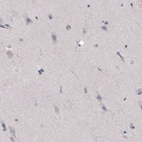 Immunohistochemical staining of human cerebral cortex shows absence of immunoreactivity (negative control).