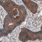 Anti-ST13 Antibody