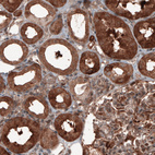 Immunohistochemical staining of human kidney shows cytoplasmic positivity in renal tubules and glomerulus cells.