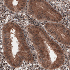 Immunohistochemical staining of human endometrium shows cytoplasmic immunoreactivity in glandular epithelium cells.