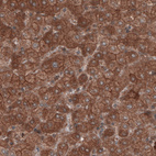 Immunohistochemical staining of human liver shows cytoplasmic positivity in hepatocytes.