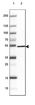 Lane 1: Marker [kDa] 250, 130, 100, 70, 55, 35, 25, 15, 10_br/_Lane 2: Human cell line RT-4