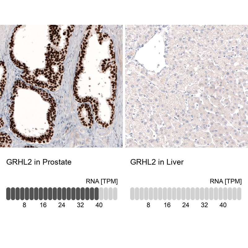 Anti-GRHL2 Antibody