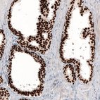 Immunohistochemical staining of human prostate shows strong nuclear positivity in glandular cells.