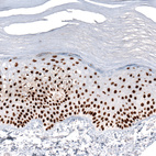 Immunohistochemical staining of human skin shows strong nuclear positivity in squamous epithelial cells.