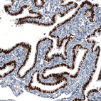 Anti-GRHL2 Antibody