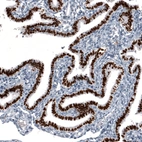 Immunohistochemical staining of human fallopian tube shows strong nuclear positivity in glandular cells.