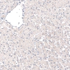 Immunohistochemical staining of human liver shows no positivity in hepatocytes as expected.