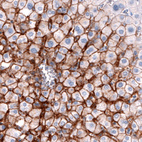 Anti-SLCO1B3 Antibody