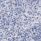 Anti-SLCO1B3 Antibody