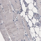 Immunohistochemical staining of human skeletal muscle shows absence of immunoreactivity (negative control).