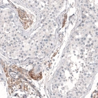 Immunohistochemical staining of human testis shows moderate membranous positivity in Leydig cells.