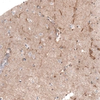Immunohistochemical staining of human cerebral cortex shows moderate positivity in neuropil.