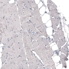 Immunohistochemical staining of human skeletal muscle shows no positivity in striated muscle fibers as expected.