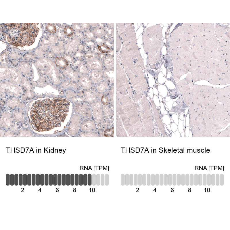 Anti-THSD7A Antibody