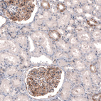 Immunohistochemical staining of human kidney shows moderate membranous positivity in cells in glomeruli, as well as in a subset of renal tubules.