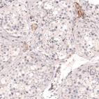 Immunohistochemical staining of human testis shows moderate membranous positivity in Leydig cells.