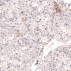 Immunohistochemical staining of human testis shows moderate membranous positivity in Leydig cells.