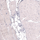 Immunohistochemical staining of human skeletal muscle shows no positivity in striated muscle fibers as expected.
