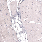 Anti-THSD7A Antibody