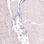 Immunohistochemical staining of human skeletal muscle shows no positivity in striated muscle fibers as expected.