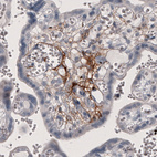 Anti-F3 Antibody