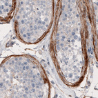 Immunohistochemical staining of human testis shows strong immunoreactivity in the lamina propria.