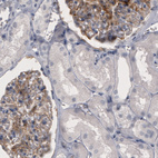 Immunohistochemical staining of human kidney shows moderate positivity in renal glomeruli.