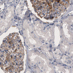 Anti-F3 Antibody