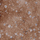 Immunohistochemical staining of human cerebral cortex shows moderate positivity in neuropil.