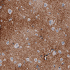 Anti-F3 Antibody