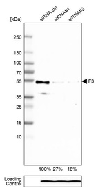 Western blot analysis in A-431 cells transfected with control siRNA, target specific siRNA probe #1 and #2, using Anti-F3 antibody. Remaining relative intensity is presented. Loading control: Anti-PPIB.