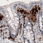 Anti-F3 Antibody