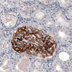 Anti-F3 Antibody