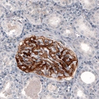 Immunohistochemical staining of human kidney shows strong positivity in renal glomerulus.